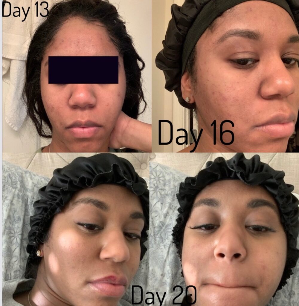 Day 13-20